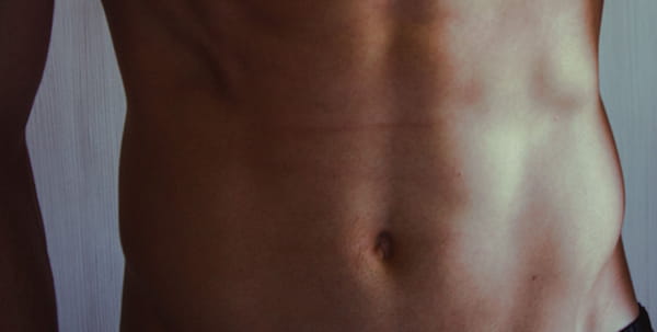 Malattie infiammatorie croniche intestinali (MICI) Malattie infiammatorie croniche intestinali (MICI)
